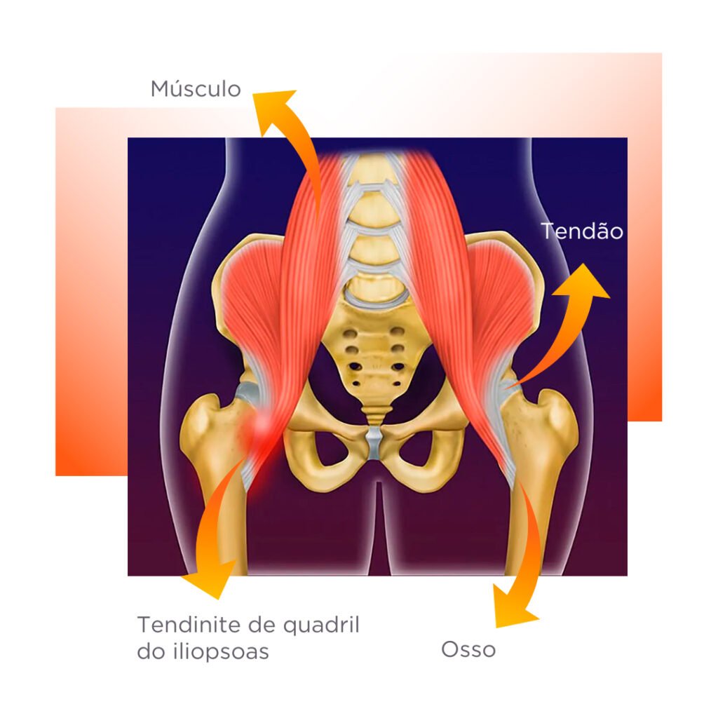 Repouso Estratégico: Dando um Respiro para o seu Quadril - inspiração 1