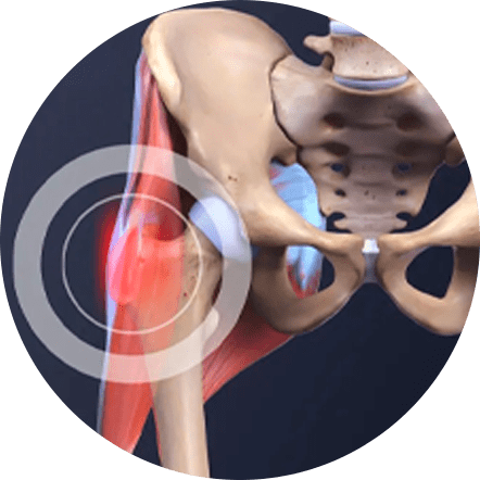 Medicamentos: Opções para Alívio da Dor e Inflamação - inspiração 1