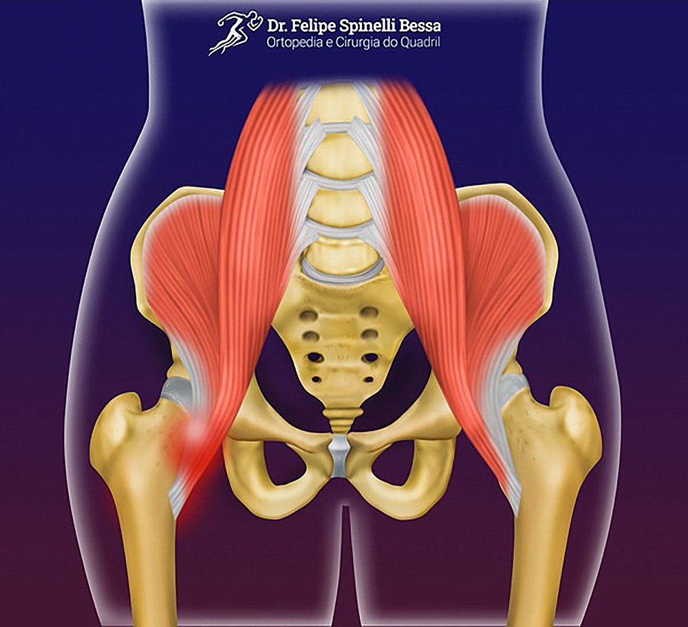 Fisioterapia: Um Plano Personalizado para Seu Tratamento - inspiração 1