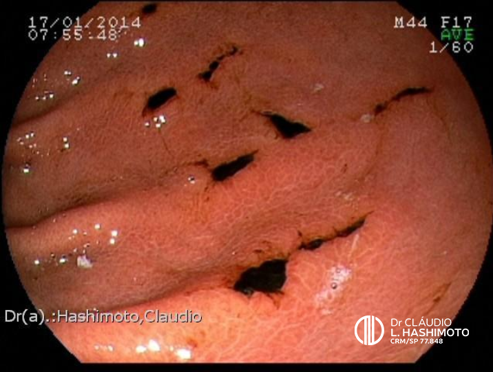 Prevenção e Cuidados a Longo Prazo: Vivendo Sem Desconforto - inspiração 1
