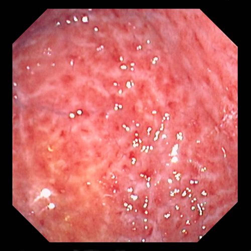 Estilo de Vida e Alimentação: Como Seus Hábitos Afetam Seu Estômago - inspiração 1