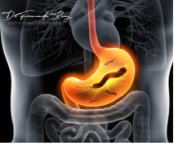 Tratamento Médico: Medicamentos Que Ajudam na Cicatrização e Controle - inspiração 1