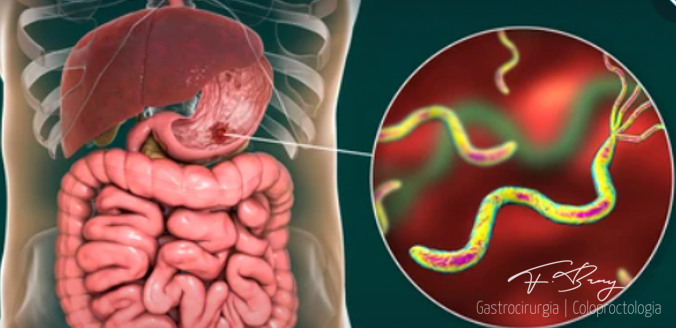 O Papel Essencial das Fibras na Recuperação Gástrica - inspiração 1