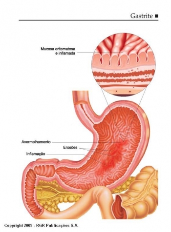 H3 Técnicas de Relaxamento para o Dia a Dia - inspiração 1