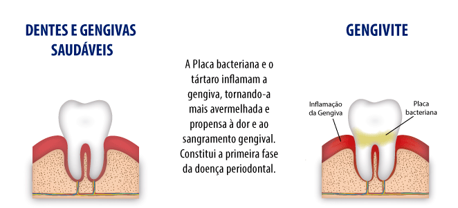A Higiene Bucal Impecável é o Primeiro Passo Fundamental - inspiração 2