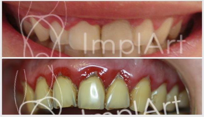 O Poder do Enxaguante Bucal no Seu Tratamento - inspiração 1