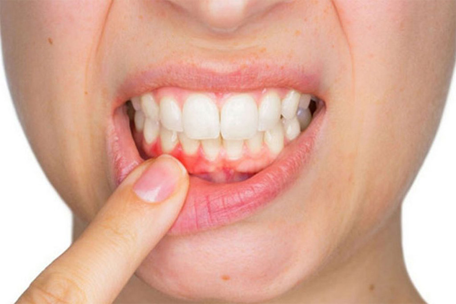 Raspagem Manual: Uma Técnica Que Você Pode Dominar - inspiração 1