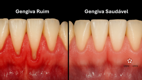 Raspagem Manual: Uma Técnica Que Você Pode Dominar - inspiração 2