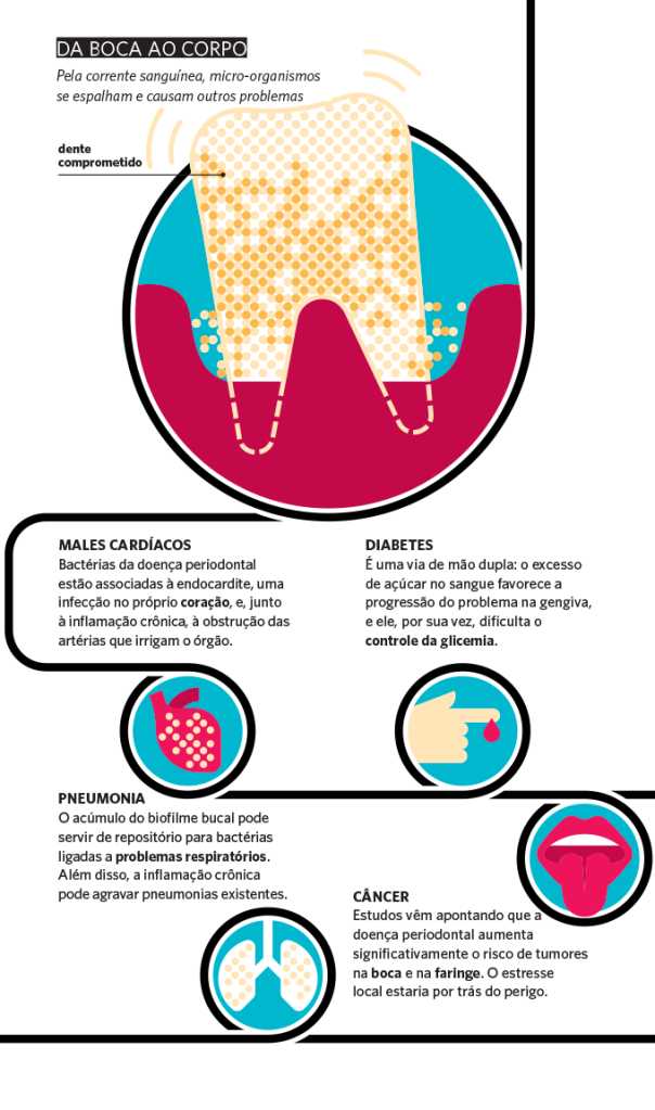 A Importância da Limpeza Entre os Dentes (Fio Dental ou Escova Interdental) - inspiração 1
