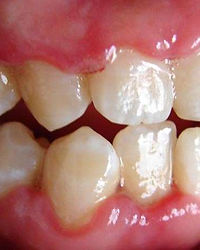 Atenção aos Sinais de Piora: Quando Procurar Ajuda Imediatamente - inspiração 2