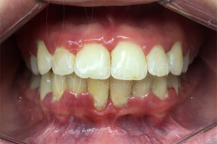 Identificando os Primeiros Sinais: Não Ignore o Sangramento! - inspiração 1