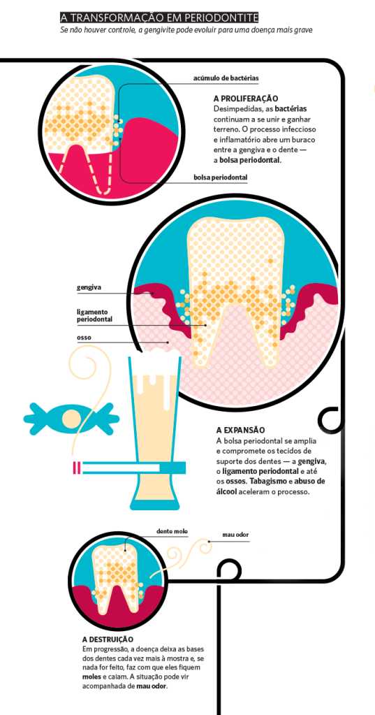 Identificando os Primeiros Sinais: Não Ignore o Sangramento! - inspiração 2