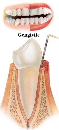 Tratamento Caseiro Eficaz: O Que Funciona de Verdade? - inspiração 2