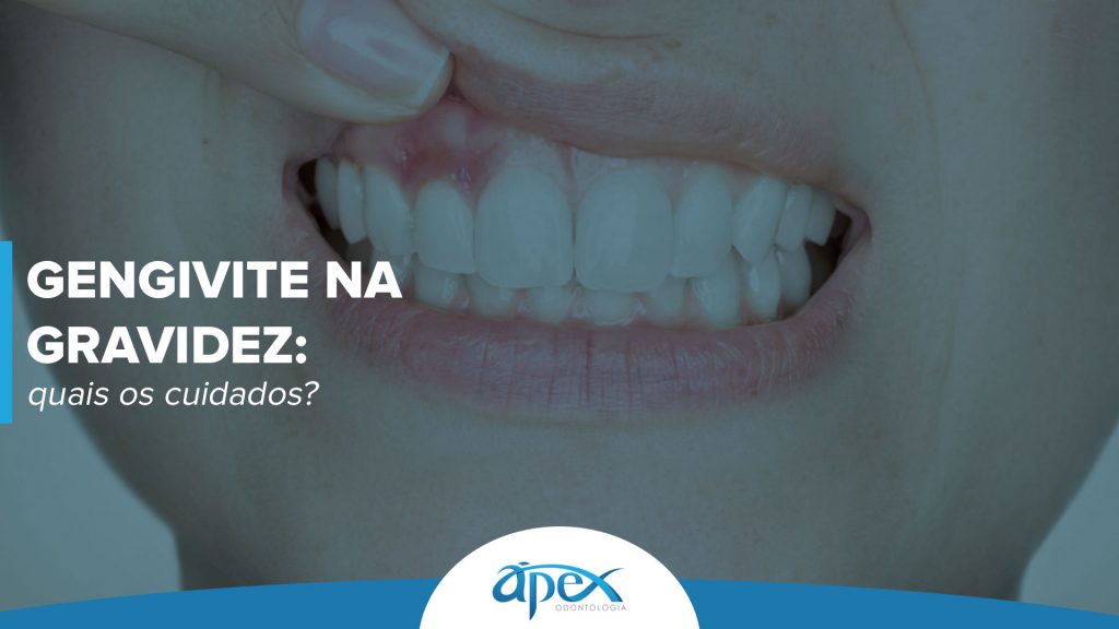 Identificando os primeiros sinais da gengivite gestacional - inspiração 1