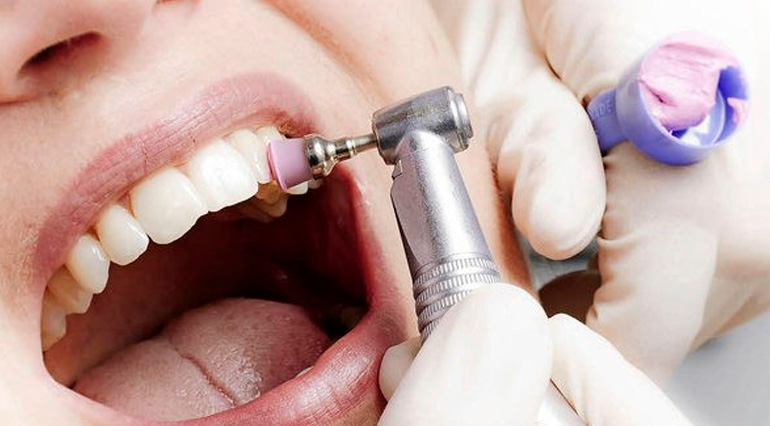A importância das visitas regulares ao dentista - inspiração 2