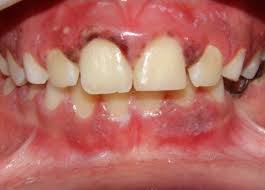 Os Primeiros Sinais: O Que Procurar na Boca do Seu Filho - inspiração 2