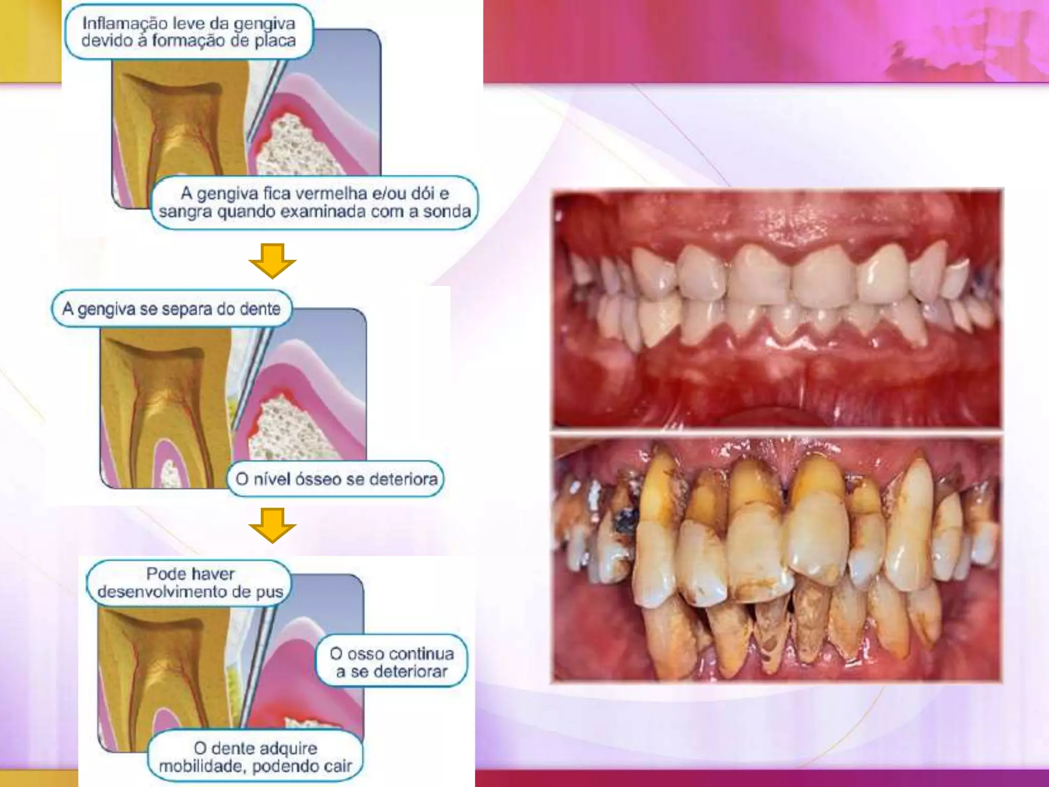 A Alimentação Certa: Conforto e Nutrição para Gengivas Sensíveis - inspiração 1