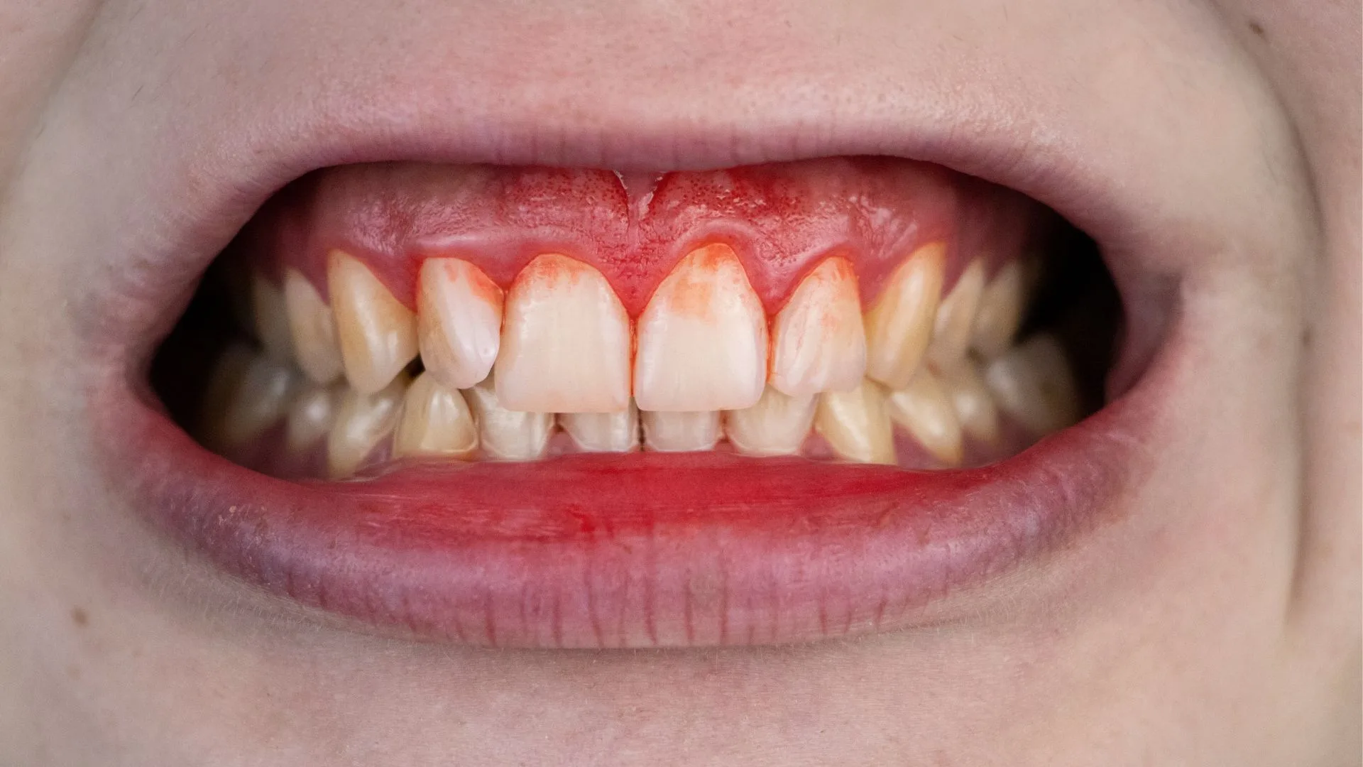 Alívio para a Dor: Métodos Seguros e Eficazes para Casa - inspiração 2