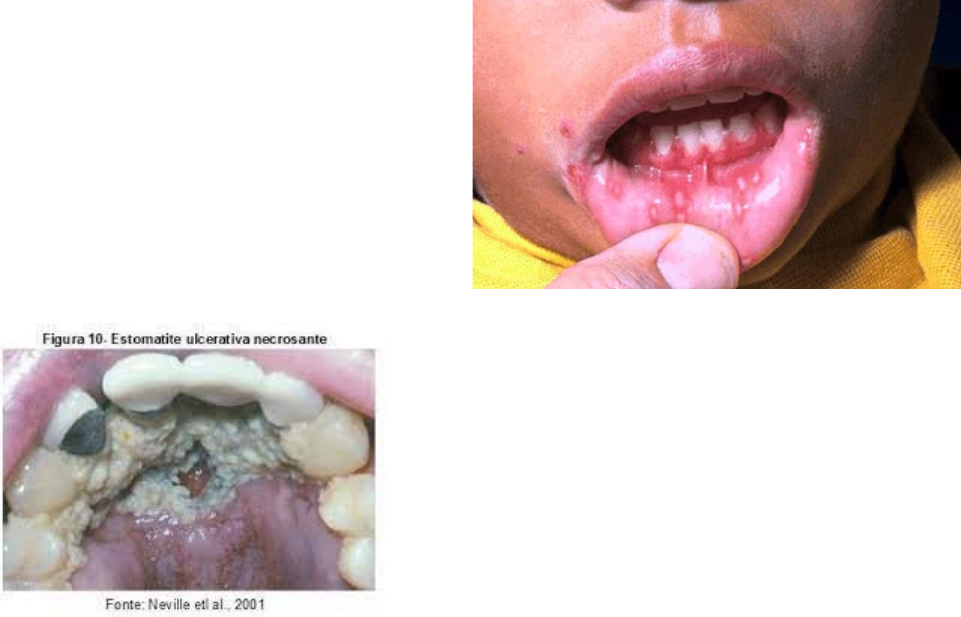Quando Procurar Ajuda Profissional Imediatamente - inspiração 2