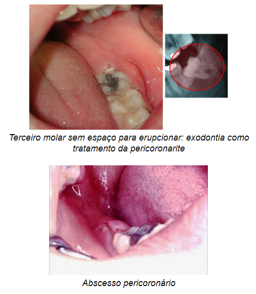 O Tratamento Odontológico: O Que Esperar no Consultório - inspiração 2