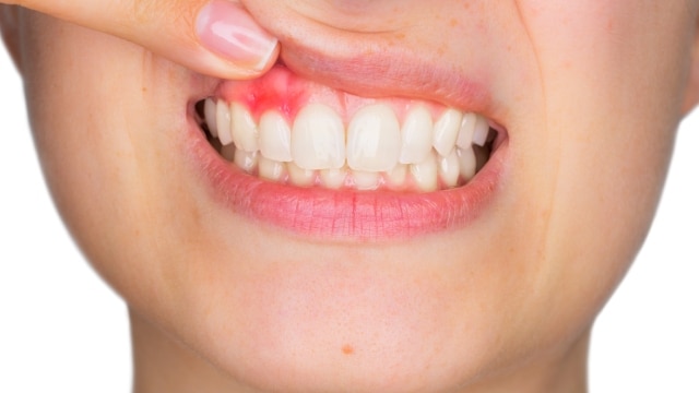 Cuidados Pós-Tratamento: Mantendo a Saúde Bucal do Seu Filho - inspiração 2