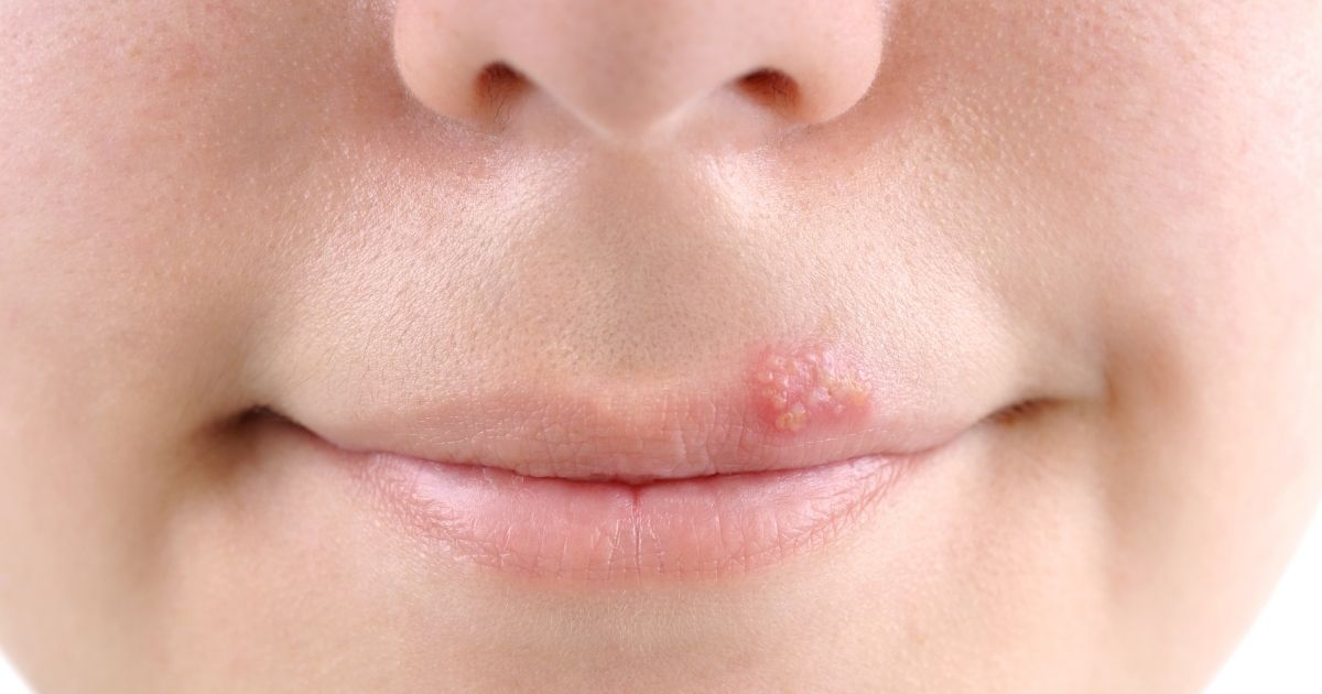 Prevenção é a Chave: Dicas Para Evitar Novas Aparecimentos - inspiração 1