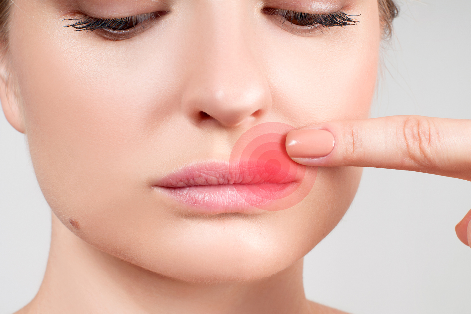 Mitos e Verdades Sobre a Herpes Labial: Desmistificando o Assunto - inspiração 2