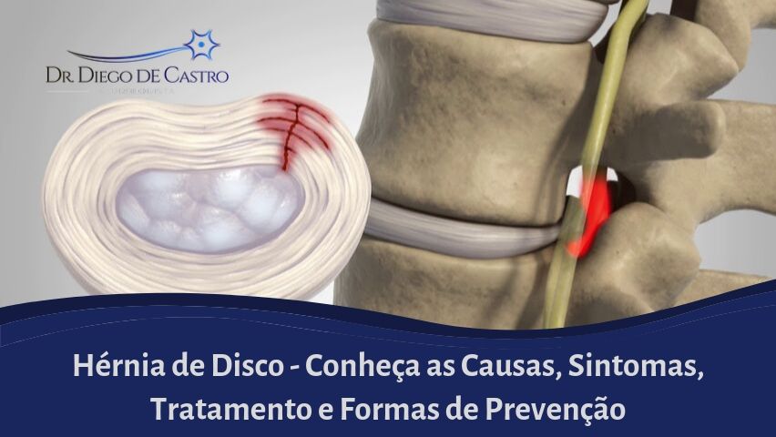 Quais os principais sintomas que você pode sentir? - inspiração 2