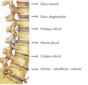 Medicamentos: quando e como usar para alívio - inspiração 1