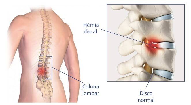 Medicamentos: quando e como usar para alívio - inspiração 2