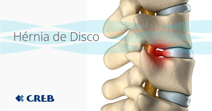 Alterações no estilo de vida que fazem a diferença - inspiração 1