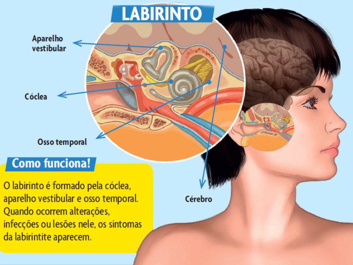 Como a cafeína pode desencadear ou piorar os sintomas da labirintite? - inspiração 1