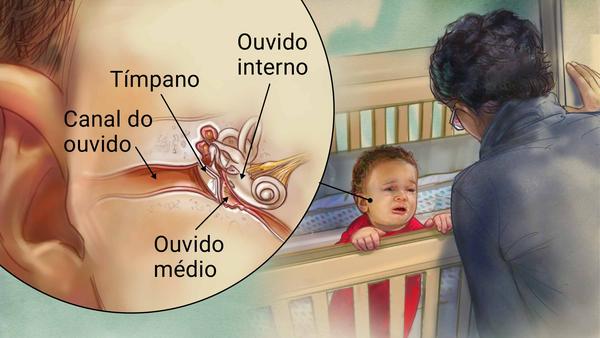 Cuidados Específicos Para Otite Externa - inspiração 2