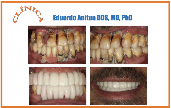O primeiro passo: Diagnóstico Preciso e Rápido - inspiração 1