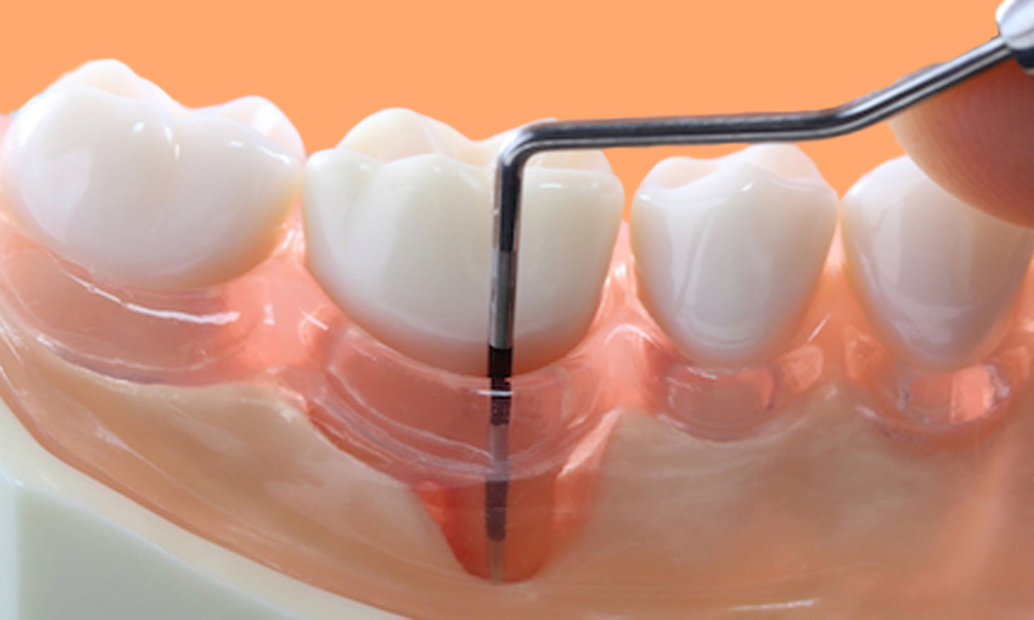 Entendendo a Higiene Bucal Adequada para Casos Específicos - inspiração 1