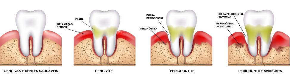 O Uso Estratégico de Antibióticos e Antimicrobianos - inspiração 1