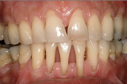 O Uso Estratégico de Antibióticos e Antimicrobianos - inspiração 2