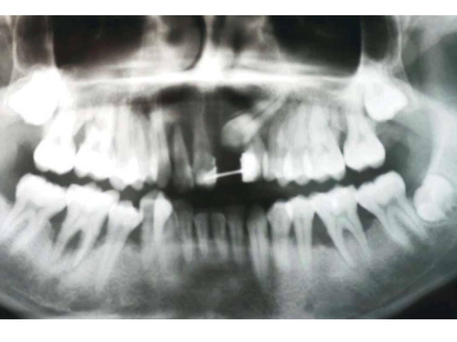 A Importância do Acompanhamento Pós-Tratamento - inspiração 2