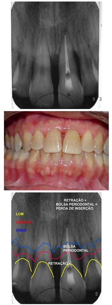 Prevenção de Recaídas: Mantendo Seu Sorriso Saudável a Longo Prazo - inspiração 2