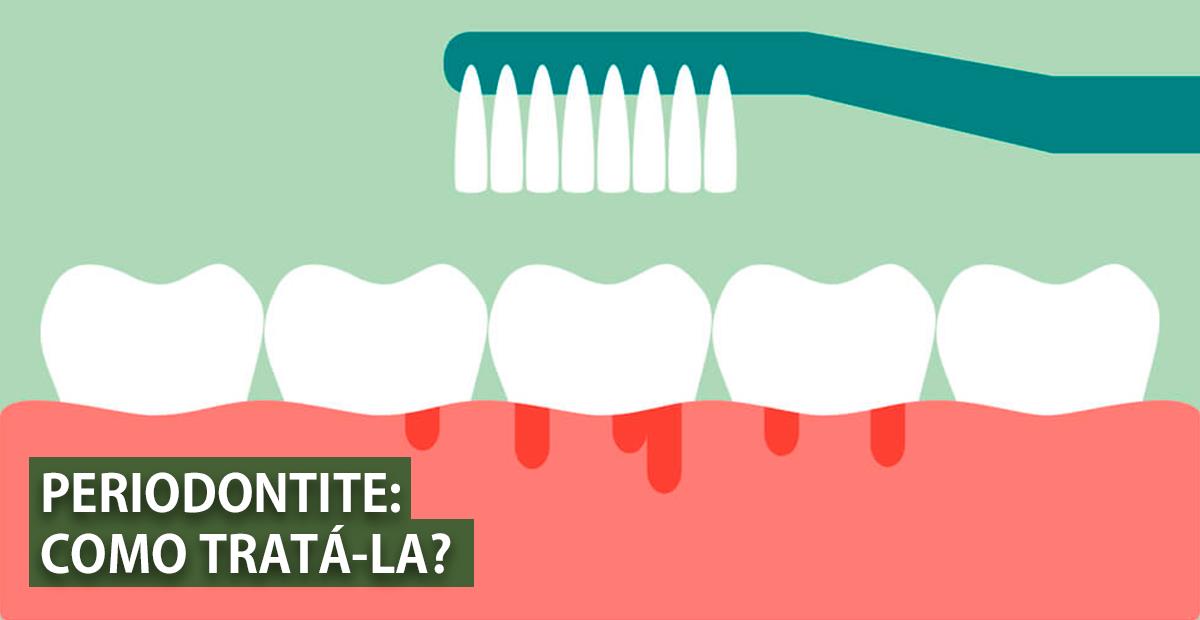 Antissépticos Bucais: Um Reforço Importante - inspiração 2
