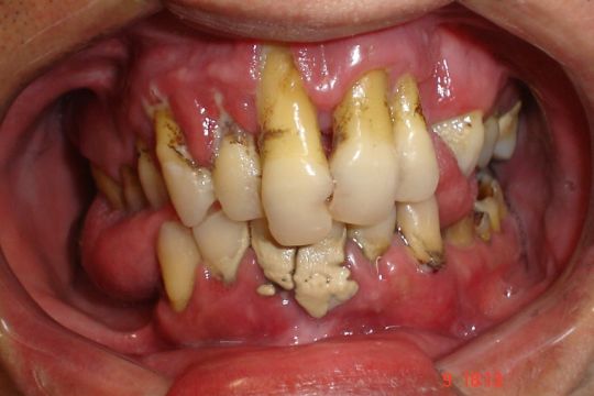 A Importância Crucial da Higiene Bucal Diária e Correta - inspiração 1
