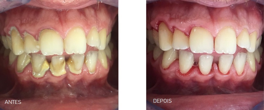 Visitas Regulares ao Dentista: Monitoramento é Chave - inspiração 2
