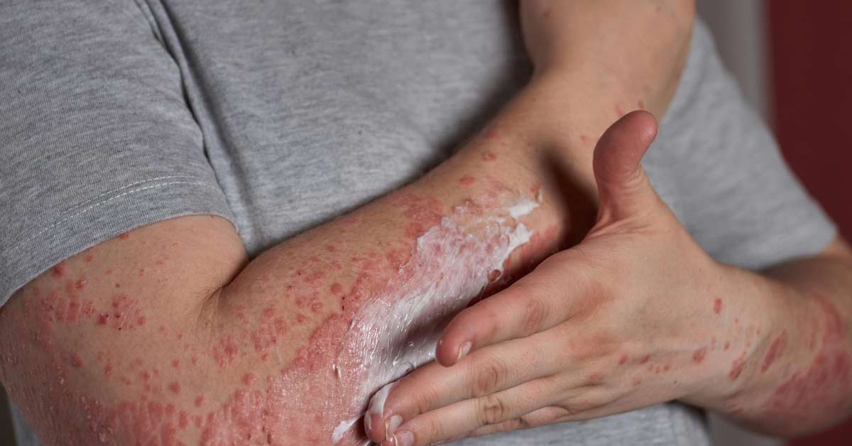 A importância da hidratação contínua para a pele - inspiração 2