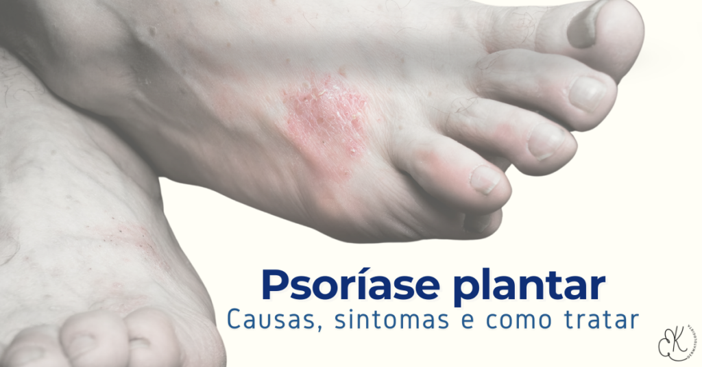 Opções de tratamento tópico: cremes e pomadas - inspiração 2