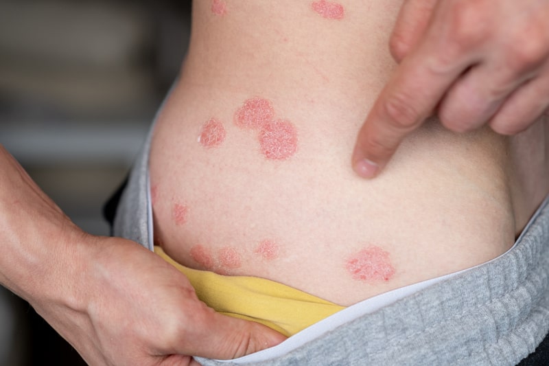 Terapias de luz (fototerapia): como funcionam - inspiração 1