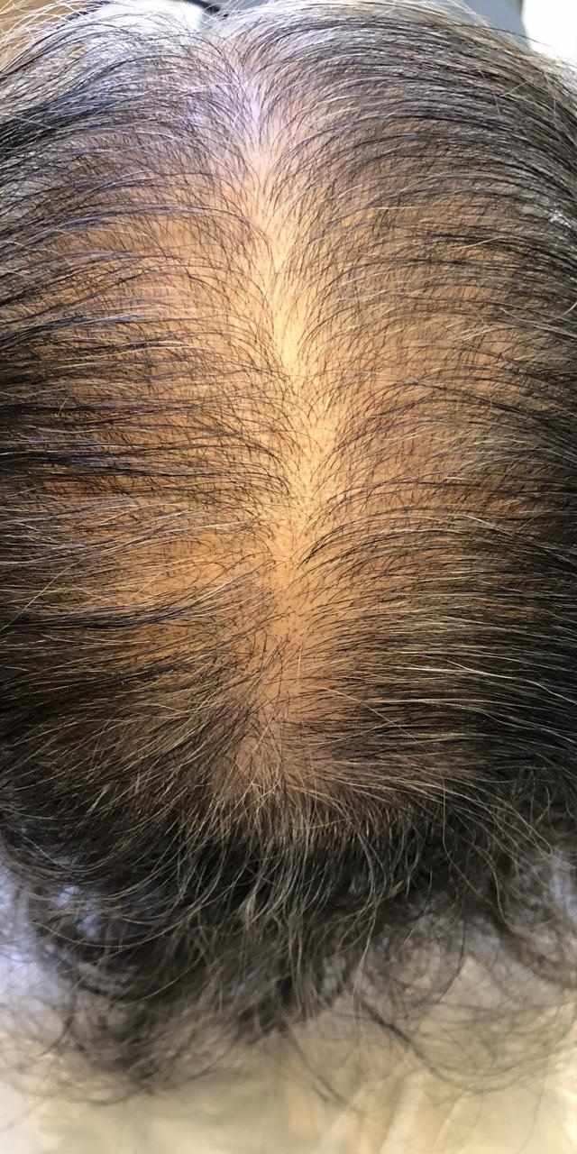 Quais vitaminas e minerais são seus maiores aliados? - inspiração 1