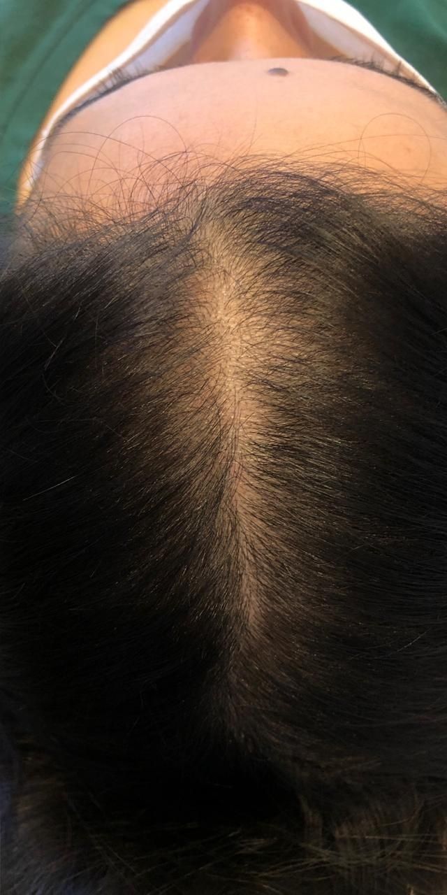 Quando considerar buscar ajuda profissional: um dermatologista amigo - inspiração 2