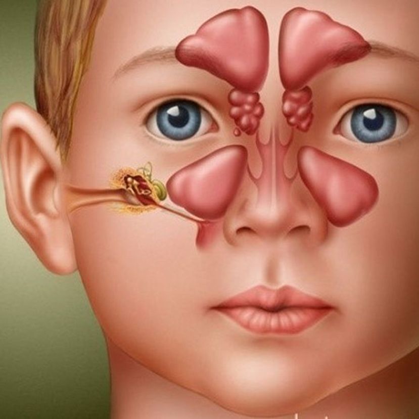 Limpeza nasal: a base do tratamento - inspiração 2