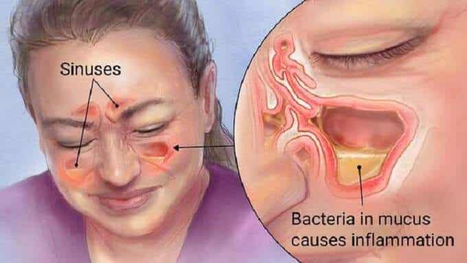 Prevenção: Estratégias para Evitar Novas Crises - inspiração 2