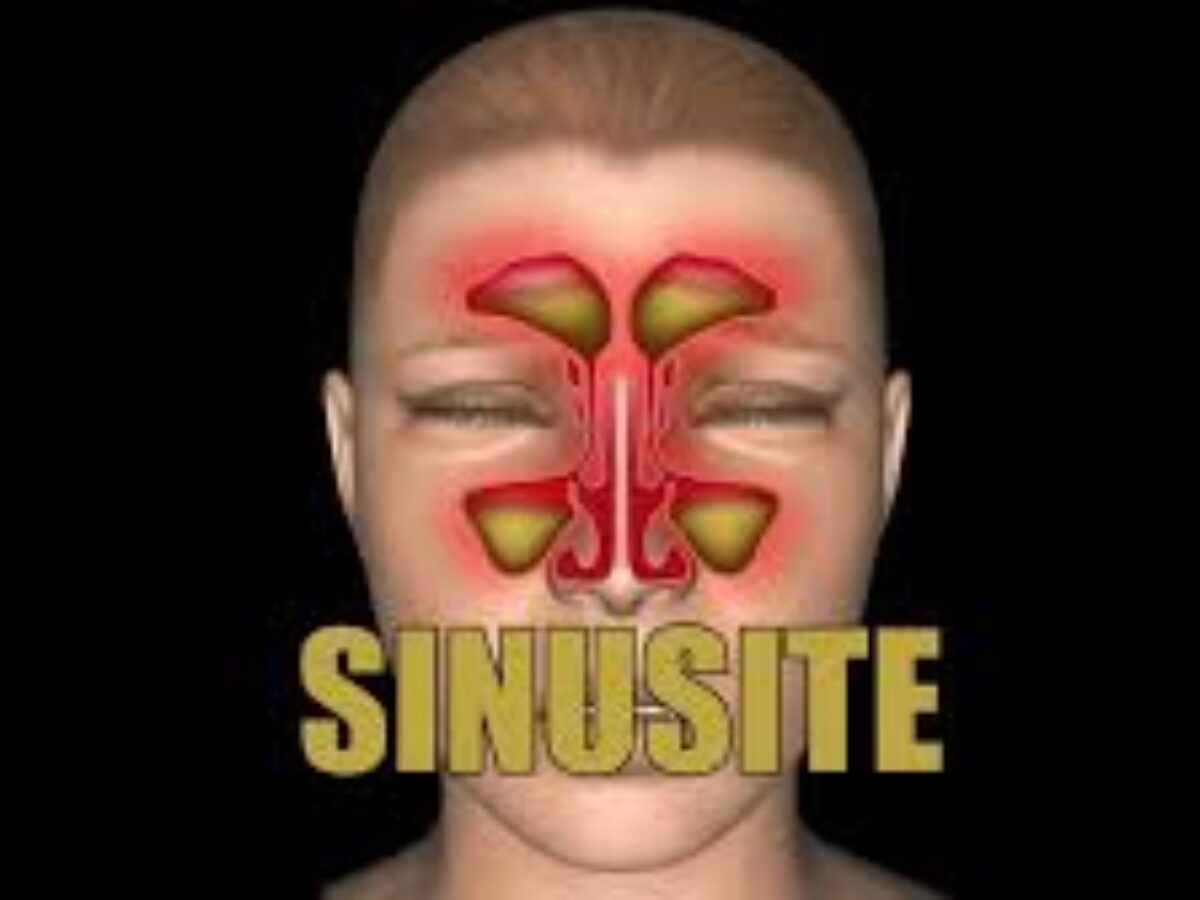 Chás Reconfortantes: Calor Que Suaviza e Limpa - inspiração 1